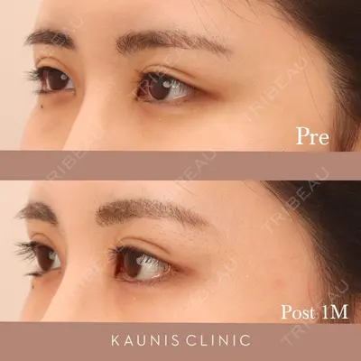 KAUNIS CLINIC（カウニスクリニック） 高野 敏郎医師の症例