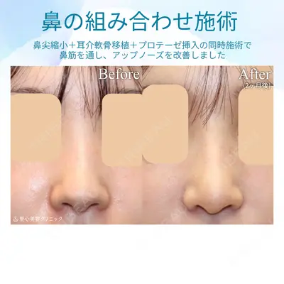聖心美容クリニック 銀座院 牧野 陽二郎医師の症例