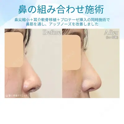 聖心美容クリニック 銀座院 牧野 陽二郎医師の症例