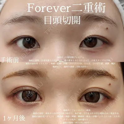 湘南美容クリニック 名古屋栄院 大須賀 啓記医師の症例