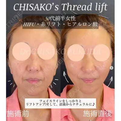 自由が丘ウェルエイジングビューティークリニック 福田 知佐子医師の症例