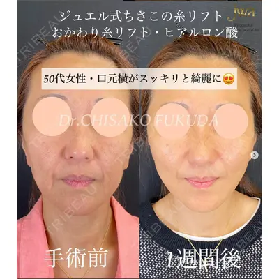 自由が丘ウェルエイジングビューティークリニック 福田 知佐子医師の症例