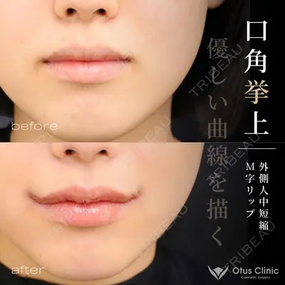 Otus Clinic 【オータスクリニック】 中 徳太郎医師の症例