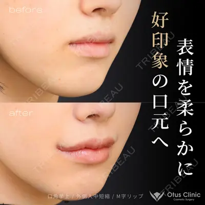 Otus Clinic 【オータスクリニック】 中 徳太郎医師の症例