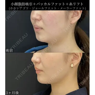 湘南美容クリニック 川崎院の症例
