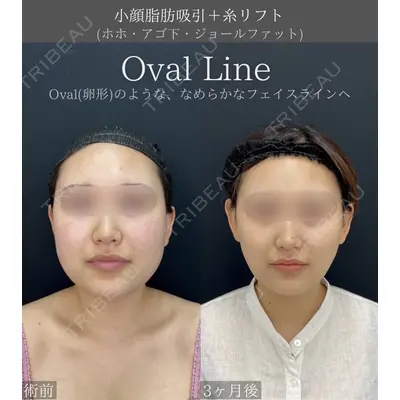 湘南美容クリニック 川崎院の症例