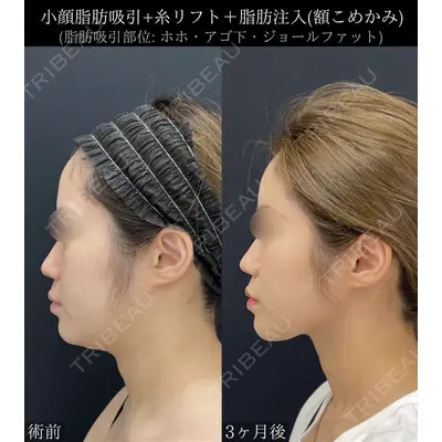 湘南美容クリニック 川崎院の症例