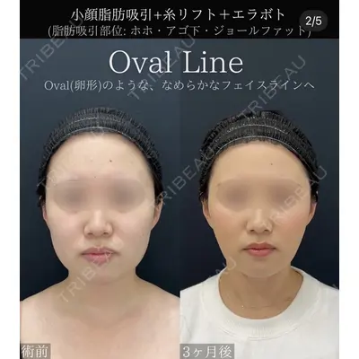 湘南美容クリニック 川崎院の症例
