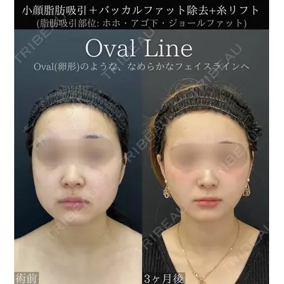 湘南美容クリニック 川崎院の症例