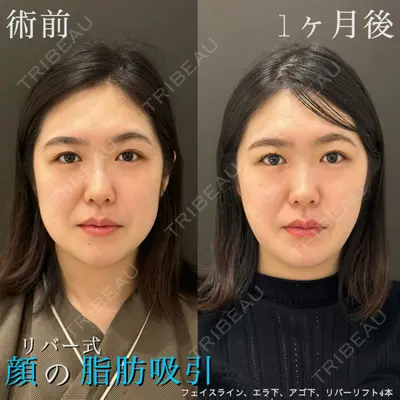 RIVER CLINIC（リバークリニック） 戸田 貴之医師の症例
