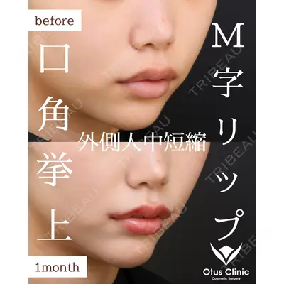 Otus Clinic 【オータスクリニック】 中 徳太郎医師の症例