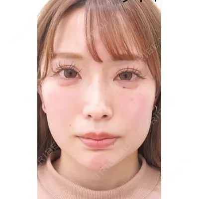 大阪TAクリニックの症例