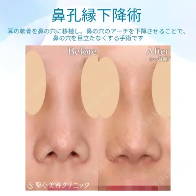 聖心美容クリニック 六本木院 菱田 健作医師の症例