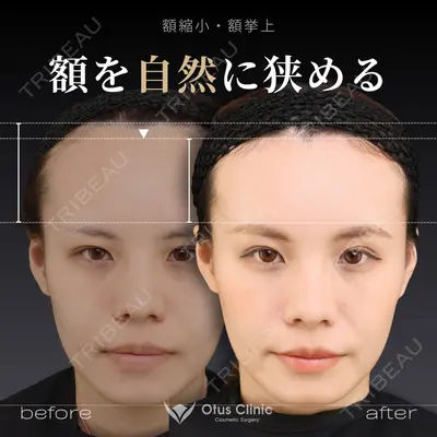 Otus Clinic 【オータスクリニック】 中 徳太郎医師の症例
