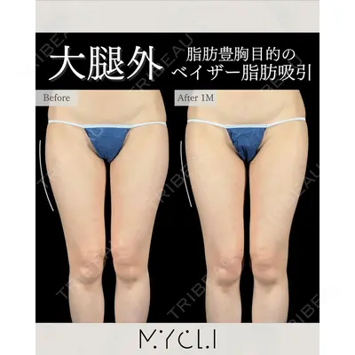 MYCLI【マイクリ】東京・恵比寿院 本田マイケル武史医師の症例