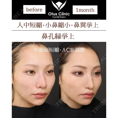 Otus Clinic 【オータスクリニック】 中 徳太郎医師の症例
