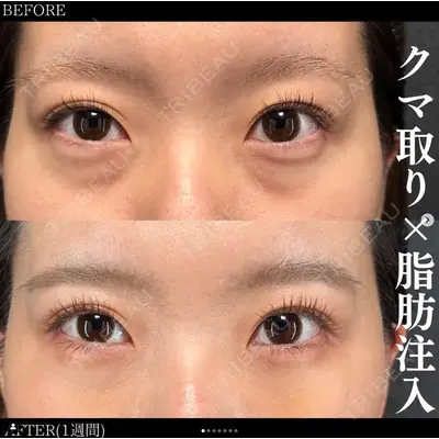 X CLINIC 恵比寿院 辻村 梢医師の症例
