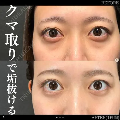 X CLINIC 恵比寿院 辻村 梢医師の症例