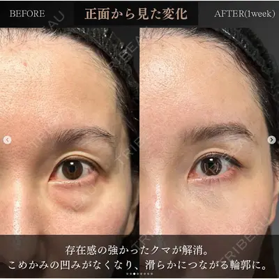 X CLINIC 恵比寿院 辻村 梢医師の症例