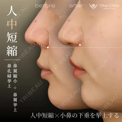 Otus Clinic 【オータスクリニック】 中 徳太郎医師の症例