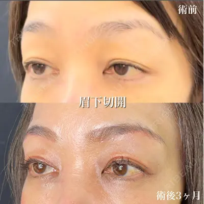 ルラ美容クリニック 新潟院の症例