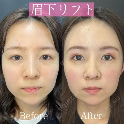 ルラ美容クリニック 渋谷本院 昼間 路子医師の症例