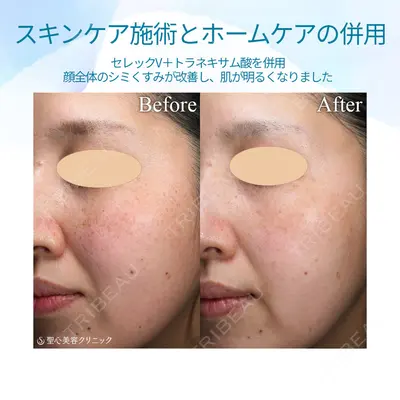 聖心美容クリニック 福岡院 美原 寿之医師の症例