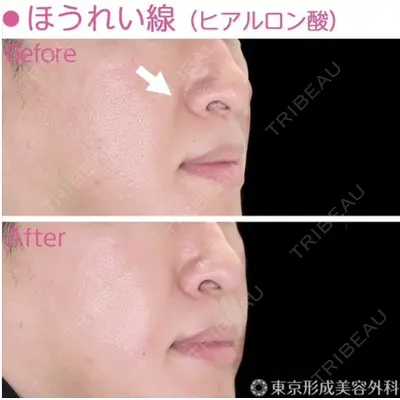 東京形成美容外科 船橋院の症例