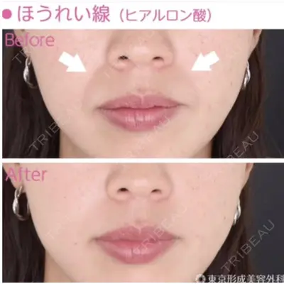 東京形成美容外科 船橋院の症例