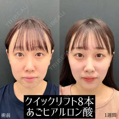 東京シンデレラ美容外科 大宮院の症例