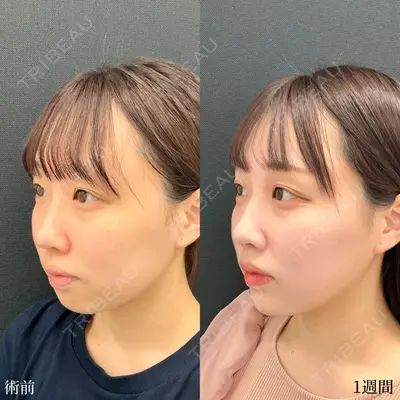 東京シンデレラ美容外科 大宮院の症例