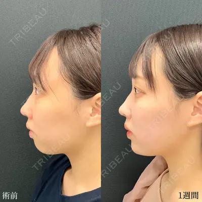 東京シンデレラ美容外科 大宮院の症例