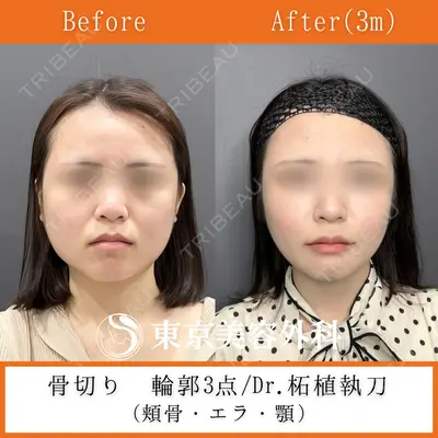 東京美容外科 赤坂院 柘植 琢哉医師の症例