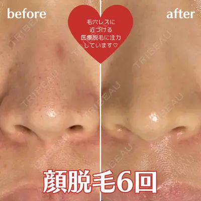 エスクリニック 恵比寿の症例