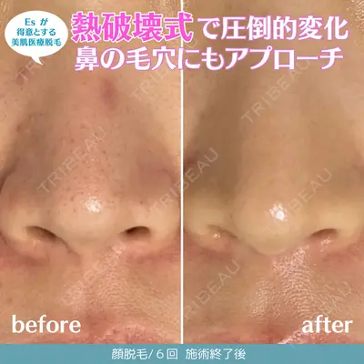 エスクリニック 恵比寿の症例