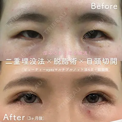 静岡中央クリニック 門司 明夫医師の症例
