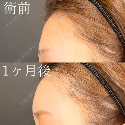 HAAB×DREAM BEAUTY CLINIC 大阪梅田院 鈴木 馨斗医師の症例