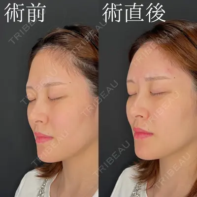 HAAB×DREAM BEAUTY CLINIC 大阪梅田院 柏木 太雅医師の症例