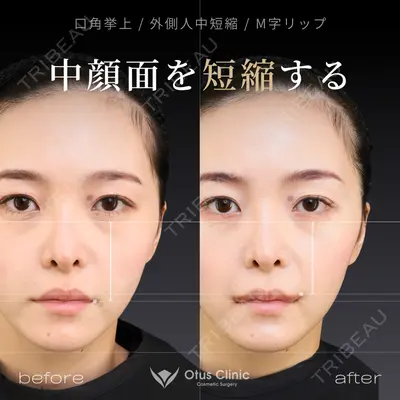 Otus Clinic 【オータスクリニック】 中 徳太郎医師の症例
