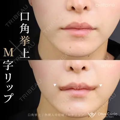 Otus Clinic 【オータスクリニック】 中 徳太郎医師の症例