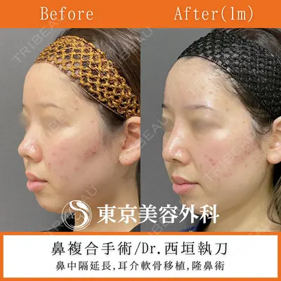 東京美容外科 秋田院の症例