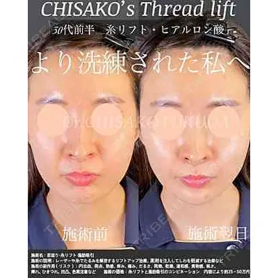 自由が丘ウェルエイジングビューティークリニック 福田 知佐子医師の症例