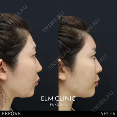 美容皮膚科エルムクリニック 福岡院 菊池 寛医師の症例