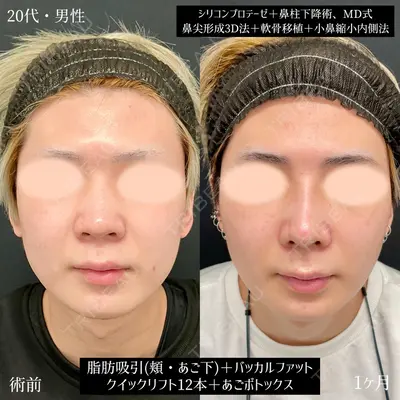 東京シンデレラ美容外科 大宮院の症例