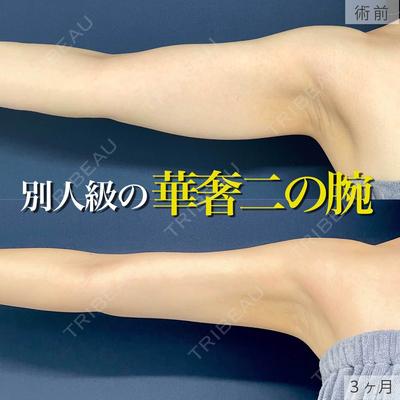 東京シンデレラ美容外科 新宿院 吉原 伯医師の症例