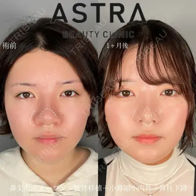 ASTRA BEAUTY CLINIC 塩満 惠子医師の症例