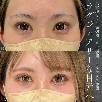 X CLINIC 恵比寿院の症例