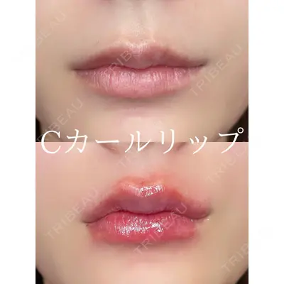 ルラ美容クリニック 大阪本院 平田 一記医師の症例