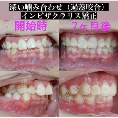 オーラルビューティークリニック クラリス審美歯科・矯正歯科 引野 貴之医師の症例