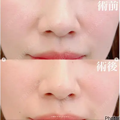 ルラ美容クリニック 横浜院 金子 真也医師の症例